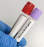 Blood sample for MLH1 or MSH2 test. Hereditary cancer panel test, Lynch syndrome or HNPCC or hereditary non-polyposis colorectal cancer. photo
