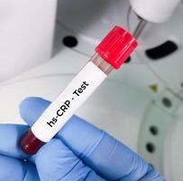 Blood sample for hs CRP or high sensitivity CRP test, for the diagnosis of inflammatory heart disease. photo