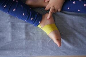 elástico terapéutico amarillo cinta aplicado a niño pierna. kinesio grabando terapia para lesión foto