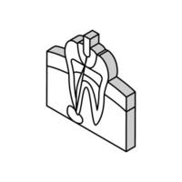 root canal treatment isometric icon vector illustration