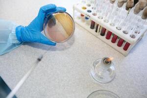 el manos de un médico laboratorio asistente en un infeccioso enfermedad laboratorio examina el muestras foto