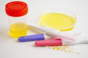 Urinalysis, urine cup with reagent strip pH paper test and comparison chart in laboratory. photo