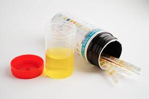 Urinalysis, urine cup with reagent strip pH paper test and comparison chart in laboratory. photo