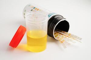 Urinalysis, urine cup with reagent strip pH paper test and comparison chart in laboratory. photo