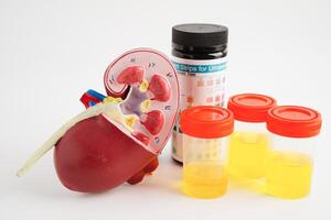 Urinalysis, Kidney and urine cup for check health examination in laboratory. photo