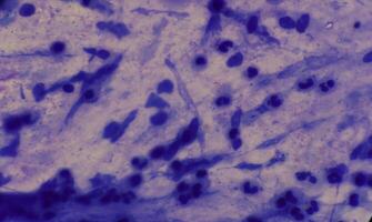 Mycobacterium tuberculosis appearance under the microscope is red with AFB staining photo