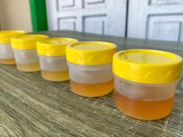 a collection of yellow urine samples on the table for laboratory examination photo