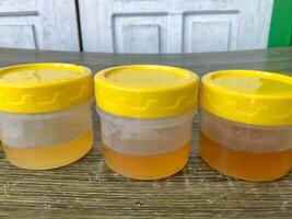 a collection of yellow urine samples on the table for laboratory examination photo