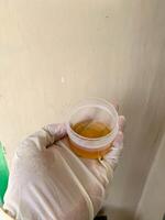 A urine sample is held in the hand of a man wearing white medical gloves photo