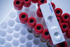 rapid test cassette of HIV showing negative test result. above the red vacuum tube photo