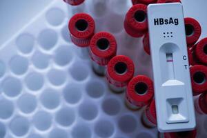 Rapid test cassette for Hepatitis B Virus Test HBsAg on a above the red vacum tube. shows a negative result.Copy space photo