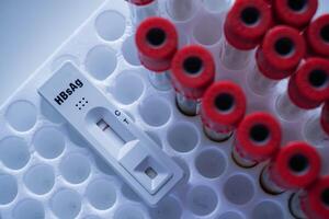 Rapid test cassette for Hepatitis B Virus Test HBsAg on a above the red vacum tube. shows a negative result.Copy space photo