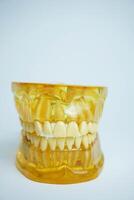 yellow jaw model on white background. Dentures or false teeth photo