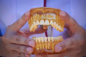 The doctors hands hold an ars. The dentist shows an example of tooth alignment. Tooth platestificial model of the jaw with break photo