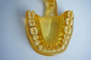 yellow jaw model on white background. Dentures or false teeth photo