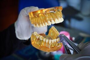 Dentist with a layout of the human jaw is showing how to extract a sick tooth with dental pliers. photo