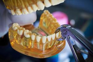 Dentist with a layout of the human jaw is showing how to extract a sick tooth with dental pliers. photo