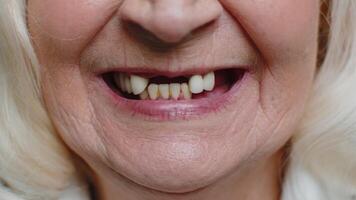 Close-up macro of toothless smile mouth of female senior woman dental problem, bad teeth loss video