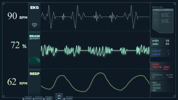 Animation of a fast electrocardiogram reading display. The heartbeats are getting more intense video