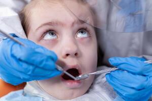 cerca arriba de niño consiguiendo caries tratamiento desde dentista en el curso de covid19 brote. dentista en coronavirus traje utilizando curvo espejo durante dientes examen de niño. foto