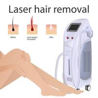 Laser hair removal of women's legs. Modern equipment for laser hair removal cosmetic procedures in a beauty salon vector