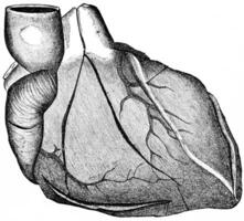 Heart showing the lines for incision in the preliminary examination and final section, fully exposing the valves, vintage engraving. photo