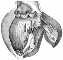 corazón con izquierda ventrículo puesto abierto, demostración el aórtico cúspides y el ventricular aspecto de mitral válvula, Clásico grabado. foto