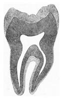 Segment of a human molar tooth, vintage engraving. photo