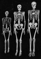 Different sizes of the human skeleton, vintage engraving. photo