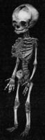 Skeleton of a newborn child with arms and legs of the same length, vintage engraving. photo