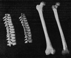 Comparative table of the vertebral column of the breast and the femur of a European and an Australian. photo