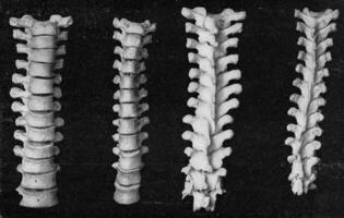 comparativo mesa de el vertebral columna de el pecho y el fémur de un europeo y un australiano, Clásico grabado. foto