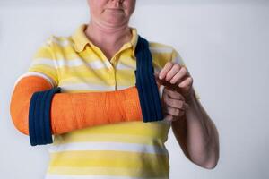 woman with a broken right arm in Fiberglass casts to hold broken bones in place until they heal, modern treatments, photo