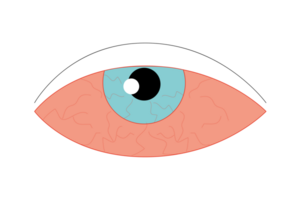 œil endolori ligne icône, maladie et allergie, œil rougeur png