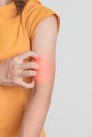 mujer Comezón y rascarse que produce picor brazo. sensible piel alérgico reacción a insecto morder, alimento, fármaco dermatitis. dermatología, lepra día, sistémico lupus eritematoso, alergia síntomas y erupción eczema foto