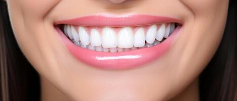 ai generado dientes blanqueo dental clínica, cosmético odontología foto