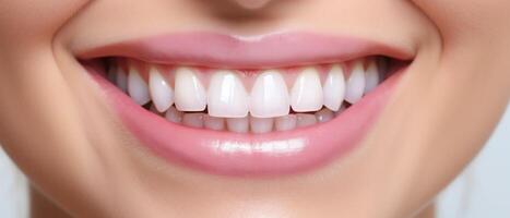 ai generado dientes blanqueo dental clínica, cosmético odontología foto