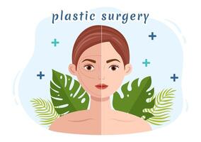 el plastico cirugía vector ilustración de médico quirúrgico operación en el cuerpo o cara como previsto utilizando avanzado equipo en dibujos animados antecedentes