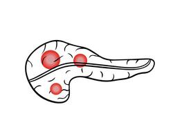 Vector isolated illustration of pancrea.Pancreatic pain. Pancreatic cancer.