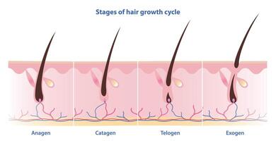 Stages of hair growth cycle vector isolated on white background. Hair grows in four distinct stages. Anagen, growing phase. Catagen, transition phase. Telogen, resting phase. Exogen, shedding phase.