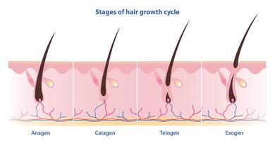 Stages of hair growth cycle vector isolated on white background. Hair grows in four distinct stages. Anagen, growing phase. Catagen, transition phase. Telogen, resting phase. Exogen, shedding phase.