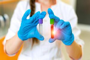 Young female scientist in protective gloves holding a red liquid substance, blood in hands. Empty and full test tubes. Chemical laboratory. photo