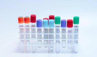 Empty laboratory test tubes. Set of tubes with colored cups. White background. Health care and analysis concept. photo