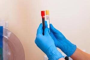 Rack of blood tubes test for analysis in the laboratory of hematology. Pneumonia diagnosing. COVID-19 and coronavirus identification. Pandemic. Assistance in scrabs with medicine tubes. photo