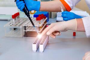 Hands of laboratory assistant in gloves analyzing blood sample. Prevention. Pneumonia diagnosting. COVID-19 and coronavirus identification. Pandemia. photo