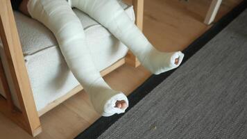 wenig Kind mit Gips Binde auf Bein. video