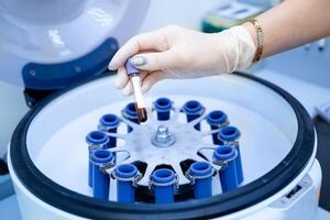 Scientist putting samples into centrifuge. Modern biotechnology equipment. photo