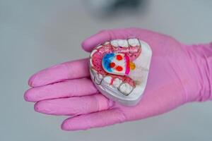 dientes modelo en mano en borroso antecedentes. el plastico dientes en uno fila con visible conectores humano mandíbula para odontología capacitación. foto