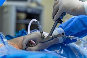 cirugía. cirujano es operando con especial equipo. médico s manos de cerca. moderno médico antecedentes foto