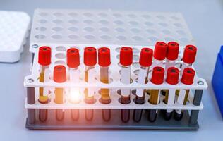 prueba tubos con sangre en un bandeja. sangre laboratorio. enfermedad pruebas. emergencia pruebas. virus infección. neumonía pruebas. covid-19 y coronavirus identificación. pandemia. foto